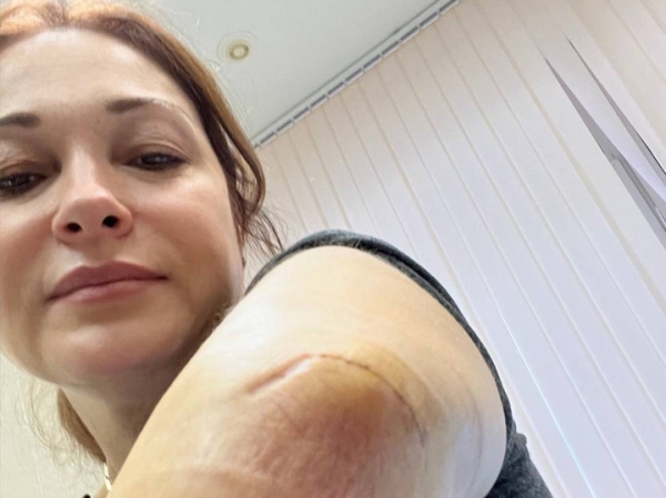 «Страшная боль»: звезда «Глухаря» Виктория Тарасова перенесла очередную операцию